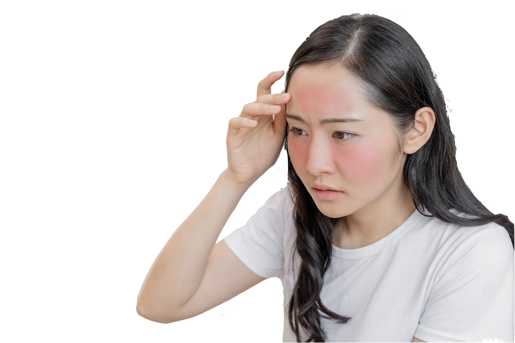 Sunburn and skin reactions on cruise