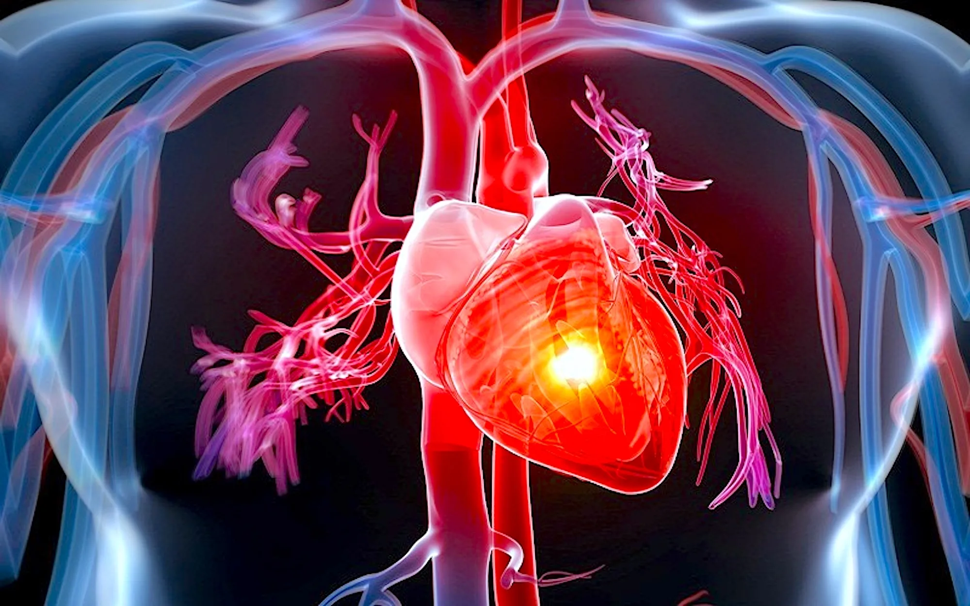 cardiac events on cruise